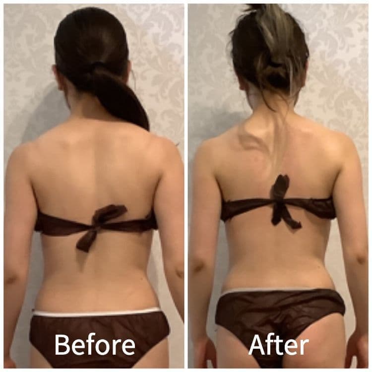 ビフォーアフター