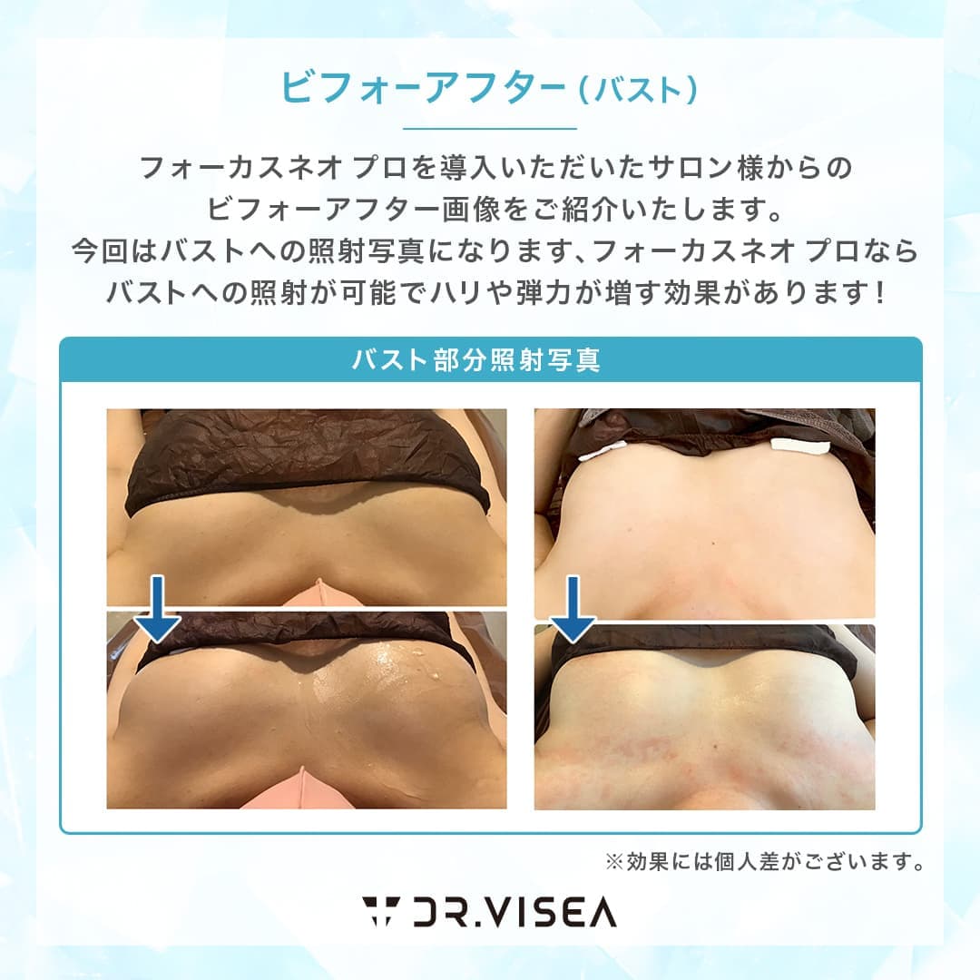 バストアップハイフ