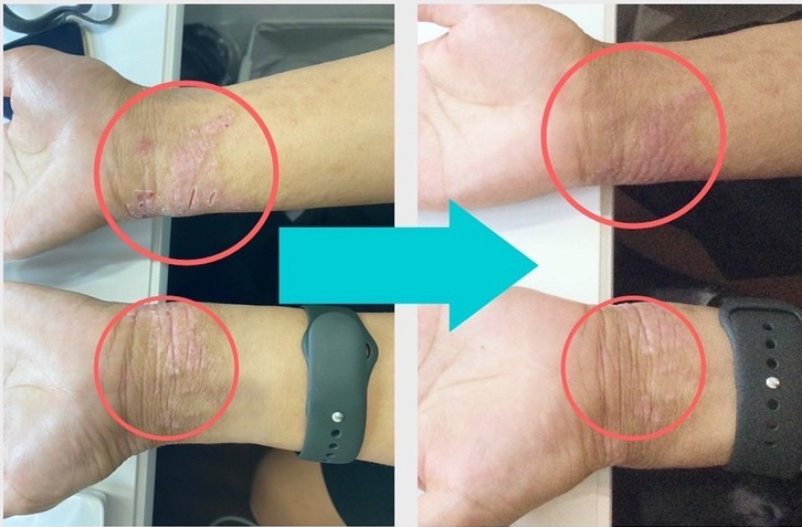 シミプラズマネオ